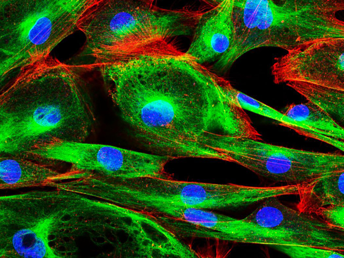 AOTF在共聚焦顯微鏡中的應(yīng)用和優(yōu)勢(shì)