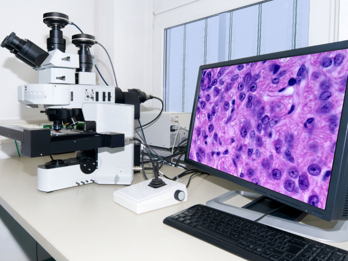 共聚焦顯微鏡，又稱共聚焦激光掃描顯微鏡（CLSM）